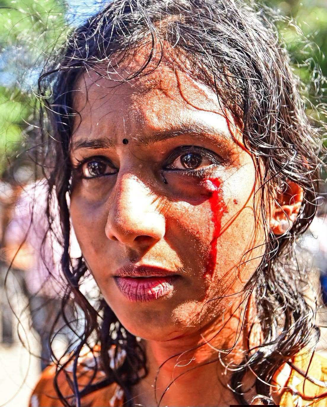 കേരള സർവകലാശാലയിലും സെക്രട്ടറിയേറ്റിലും എസ്.എഫ്.ഐ സമരം: ലാത്തിചാർജ്; ആര്യ പ്രസാദ്, വൈഷ്ണവി ഷാജി എന്നിവർക്ക് പരിക്ക്